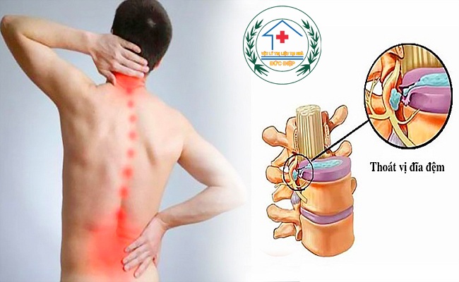 phong kham duc diep chua thoat vi dia diem tot nhat tphcm